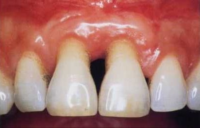 Periodontology